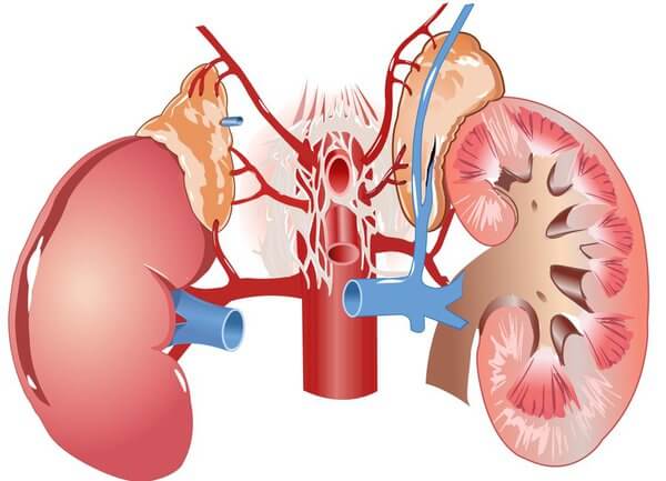 “Tan Sỏi, Lợi Thận” Bằng Cách Nào? 1 2020