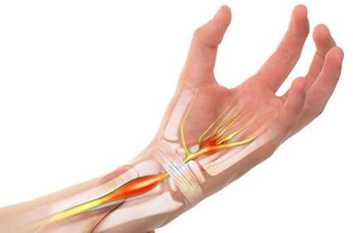 Đá Muối Hồng Có Trị Hết Bệnh Viêm Bao Gân Tay Chân Không? 1 2020 Viêm Bao Gân Là Gì? Cách Điều Trị Bệnh Như Thế Nào?