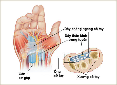 Tê Tay và Những Nguy Cơ Tiềm Ẩn Không Ngờ 1 2020 Tê Tay Báo Hiệu Sớm Của Các Bệnh Nguy Hiểm Nào