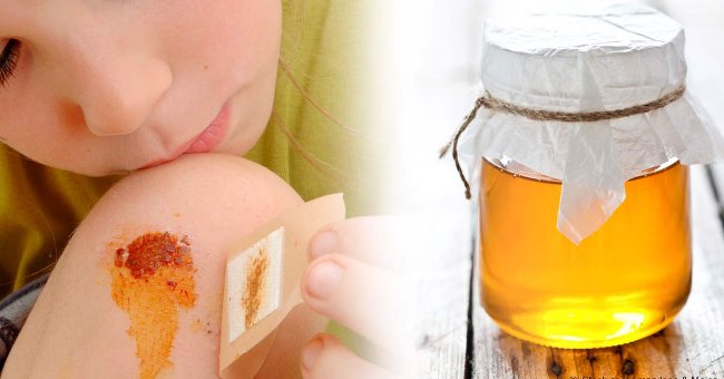 Top 10 Công Dụng Của Mật Ong Đối Với Sức Khỏe 8 2020 Top 10 Công Dụng Của Mật Ong Đối Với Sức Khỏe 3 2020